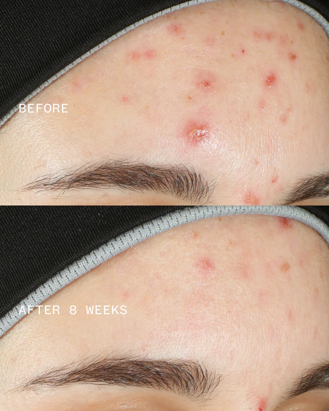 Azelaic & Kojic Advanced Clarifying Serum - Image 3