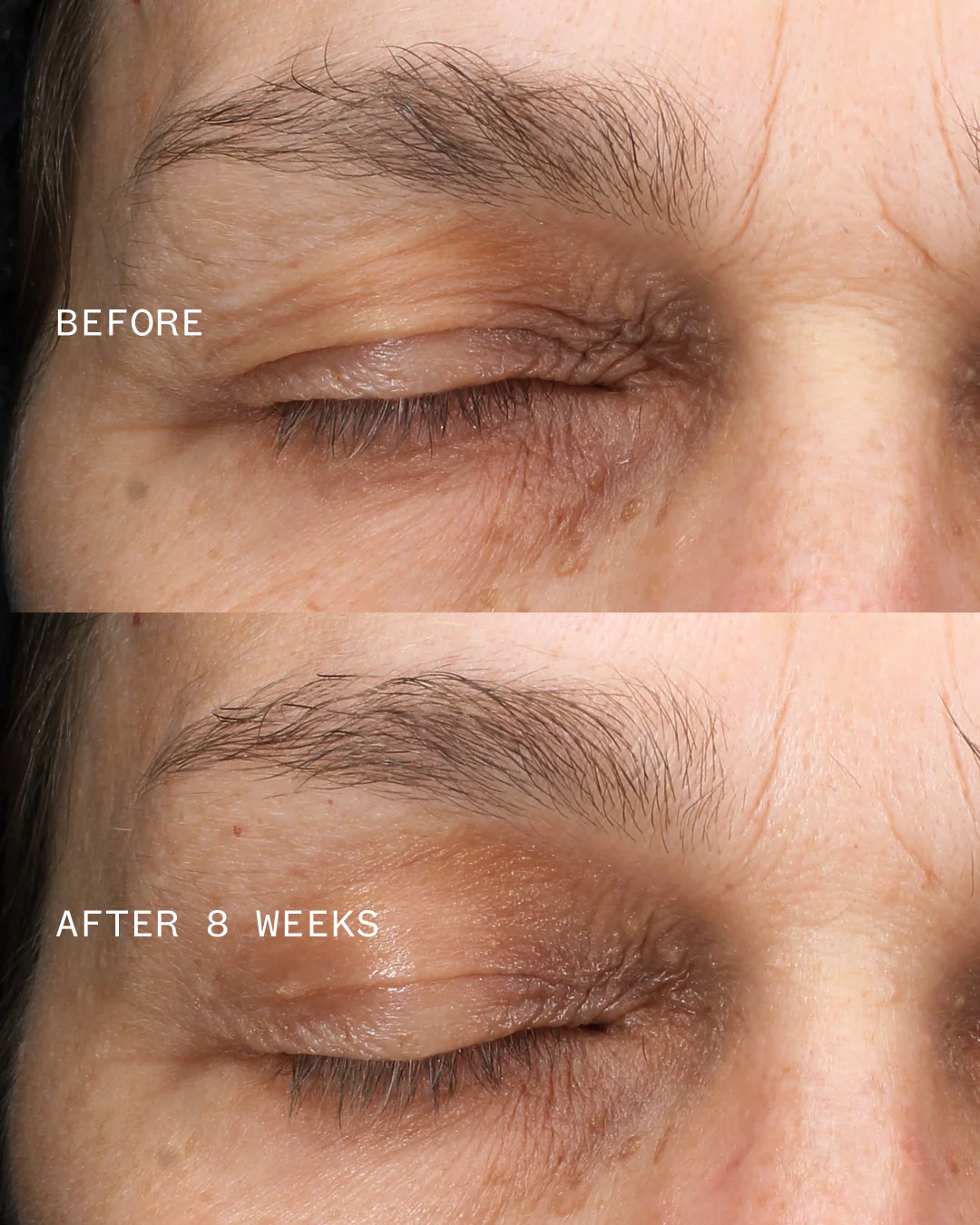 Multi Peptides & Growth Factor Advanced Lifting Serum - Image 3